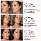 Three before-and-after photo pairs showing the jawline, neck and cheek of three women, each paired with a self-reported survey percentage.