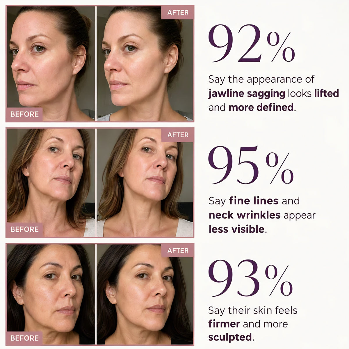 Three before-and-after photo pairs showing the jawline, neck and cheek of three women, each paired with a self-reported survey percentage.